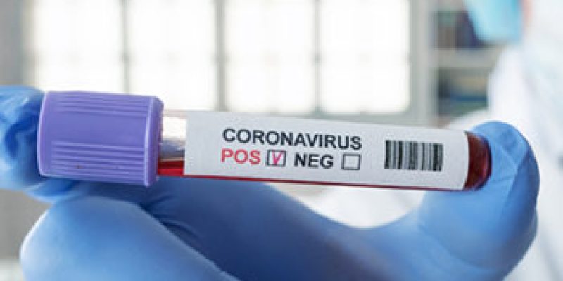 Coronavirus blood test in hospital laboratory